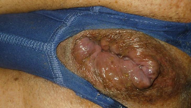 20P Magnificent male cunt 2
