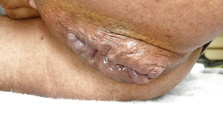 20P Magnificent male cunt 2