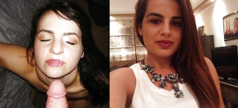 13P Before and After Facials