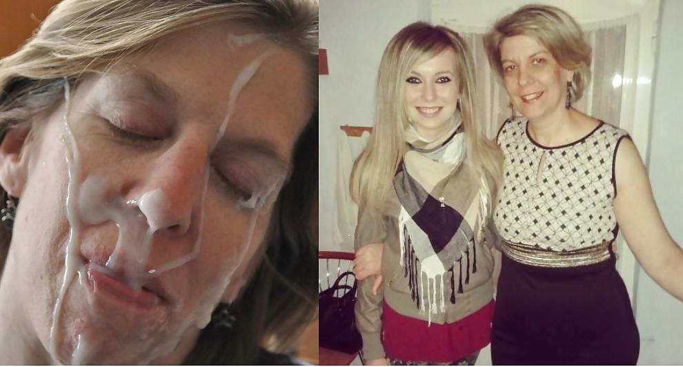 13P Before and After Facials