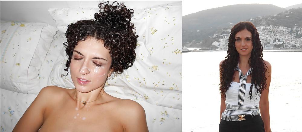 13P Before and After Facials