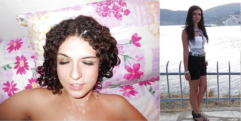 13P Before and After Facials