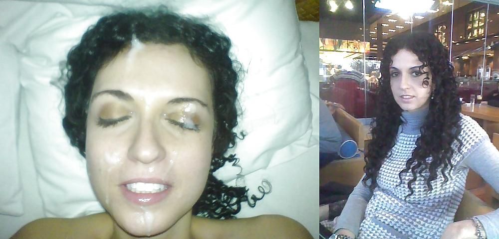 13P Before and After Facials