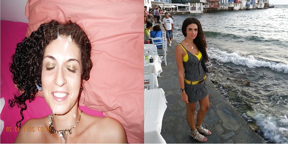 13P Before and After Facials