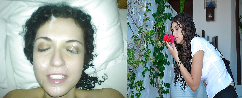 13P Before and After Facials