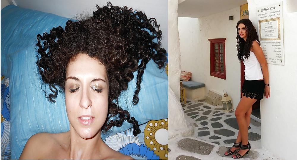13P Before and After Facials