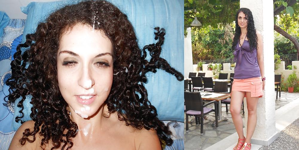 13P Before and After Facials