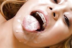 13P There is something on your braces