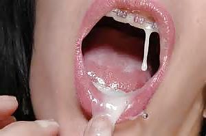 13P There is something on your braces