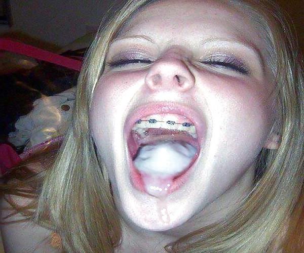 13P There is something on your braces