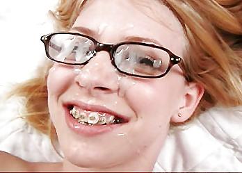 13P There is something on your braces