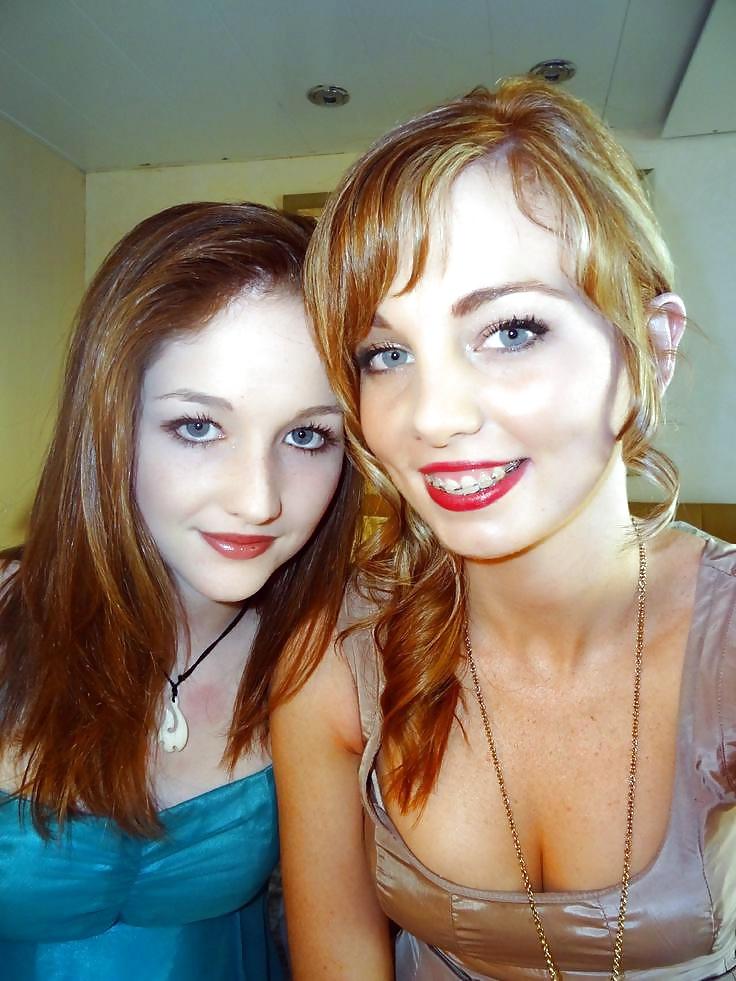 25P Teens With Braces 2