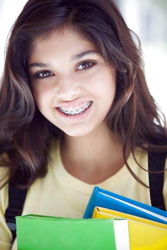 25P Teens With Braces 2