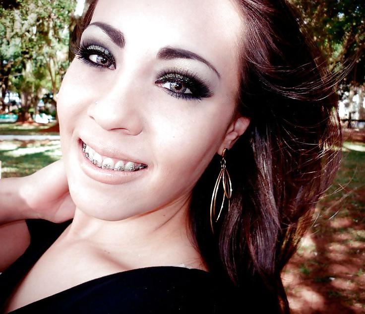 25P Teens With Braces 2