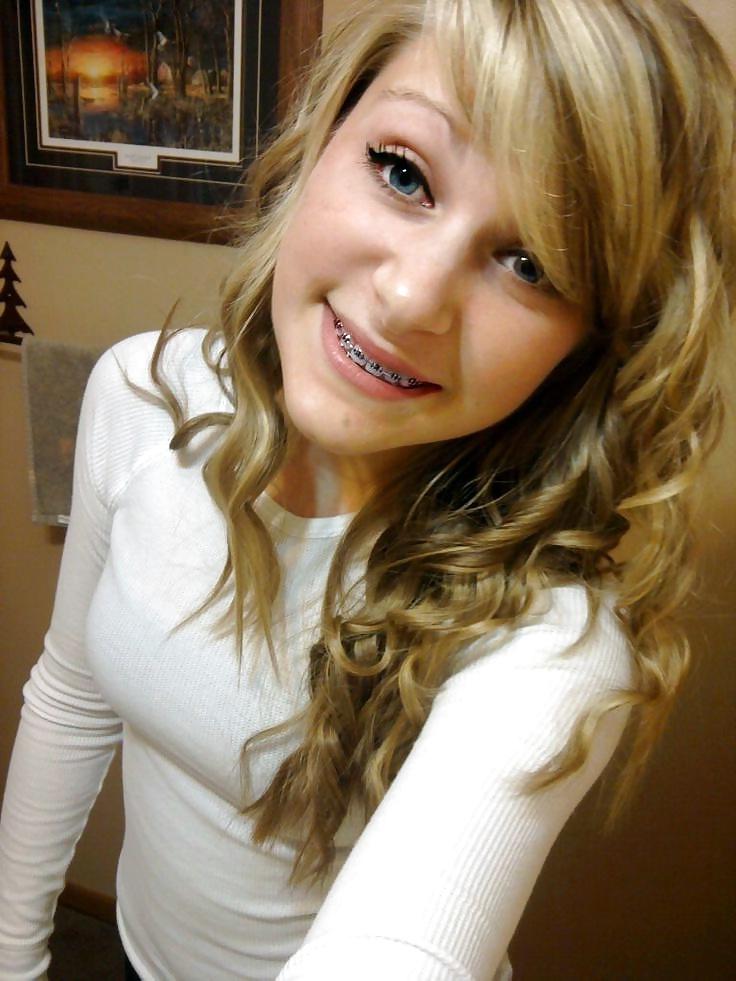 25P Teens With Braces 2