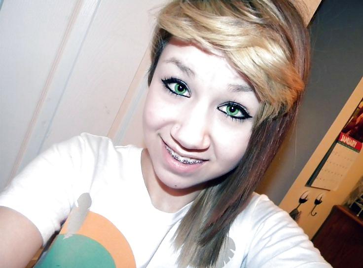 25P Teens With Braces 2