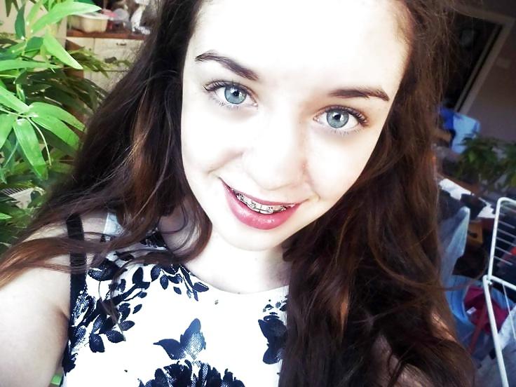 25P Teens With Braces 2