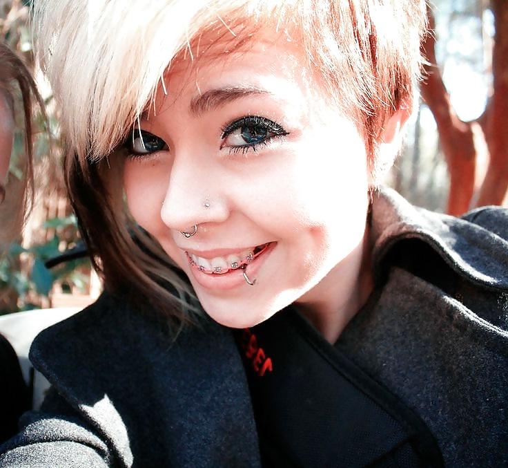 25P Teens With Braces 2