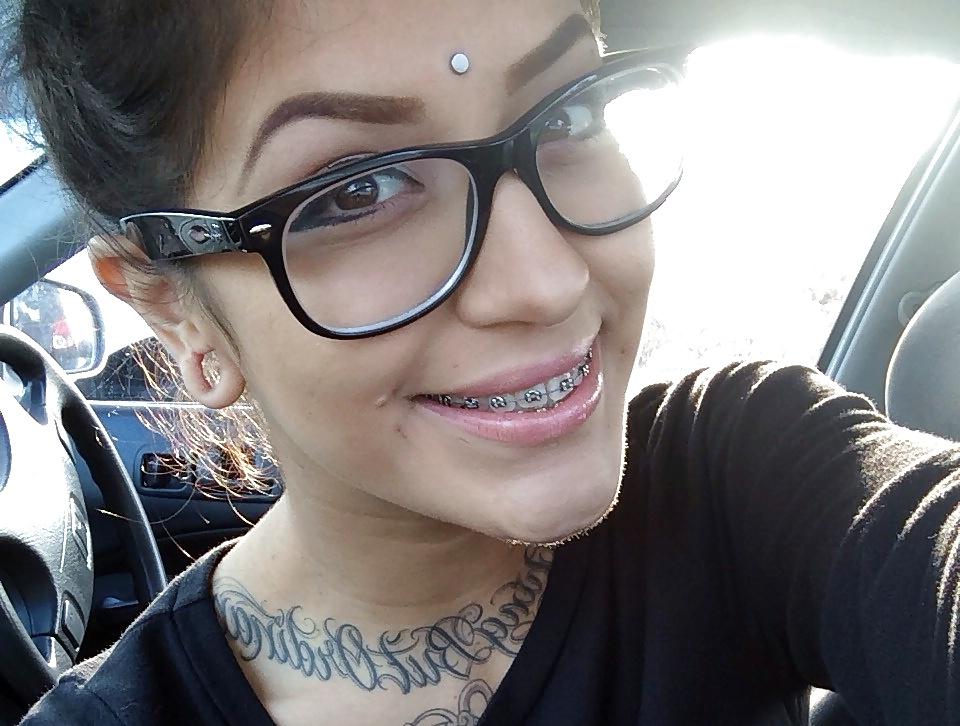 25P Teens With Braces 2