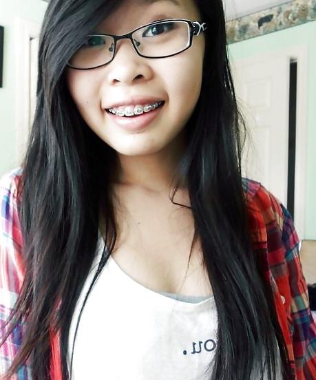 25P Teens With Braces 2
