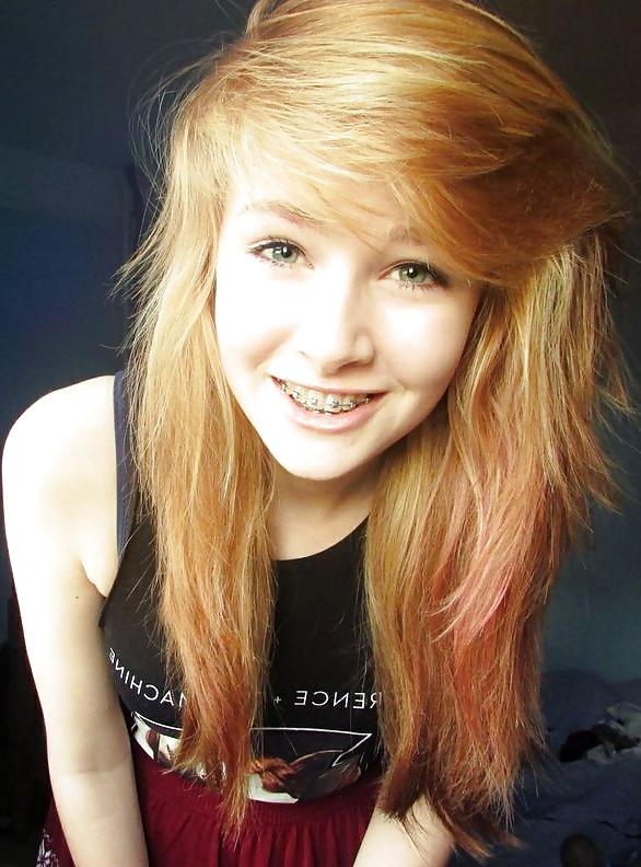 25P Teens With Braces 2