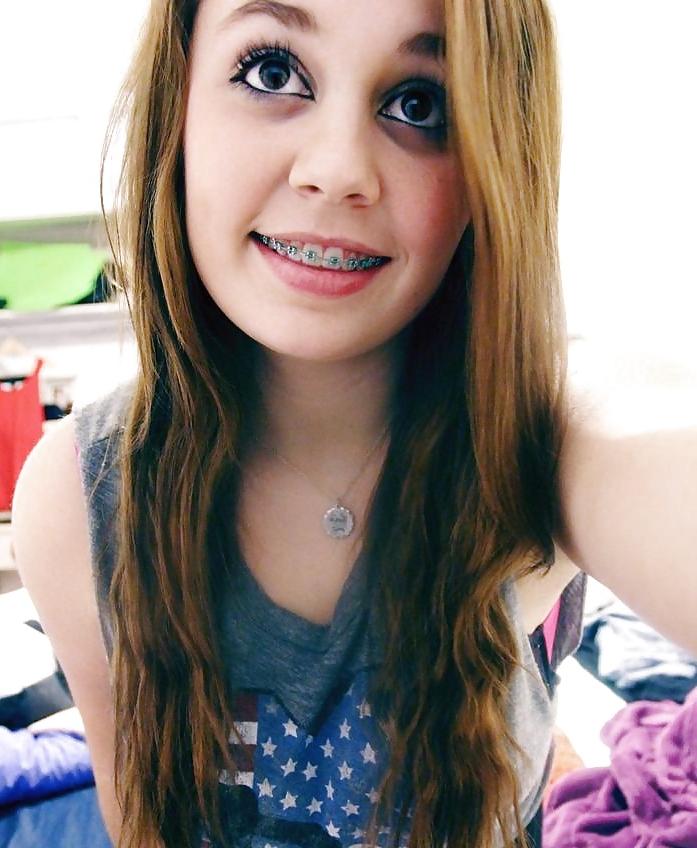 25P Teens With Braces 2