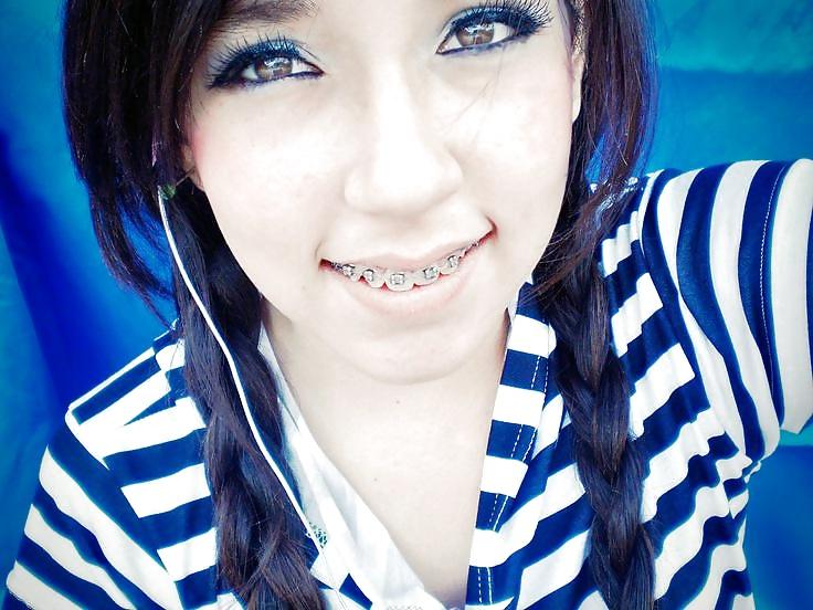 25P Teens With Braces 2