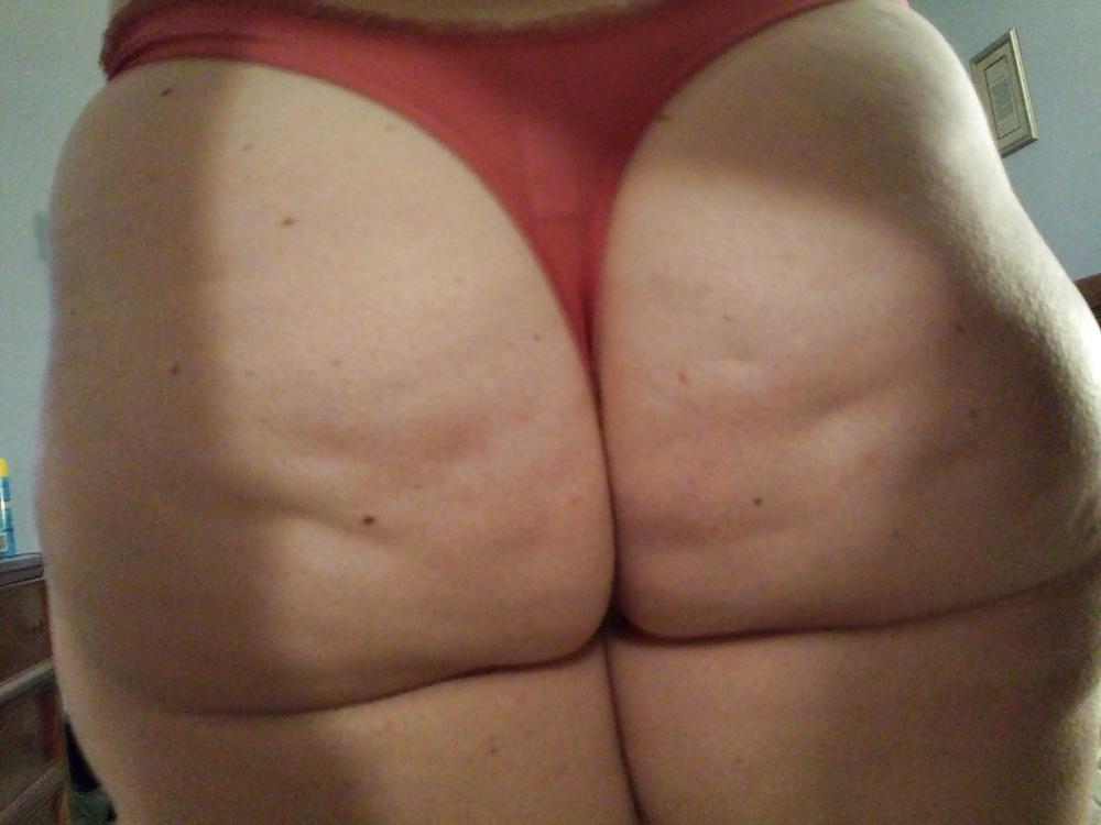 25P Thick, White and Cellulite 122