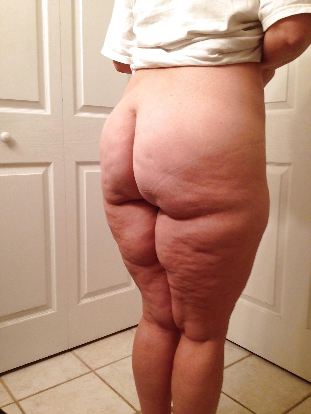 25P Thick, White and Cellulite 122