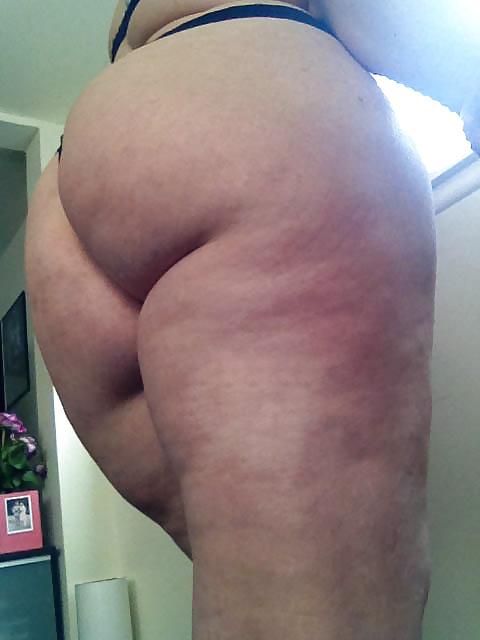 25P Thick, White and Cellulite 122