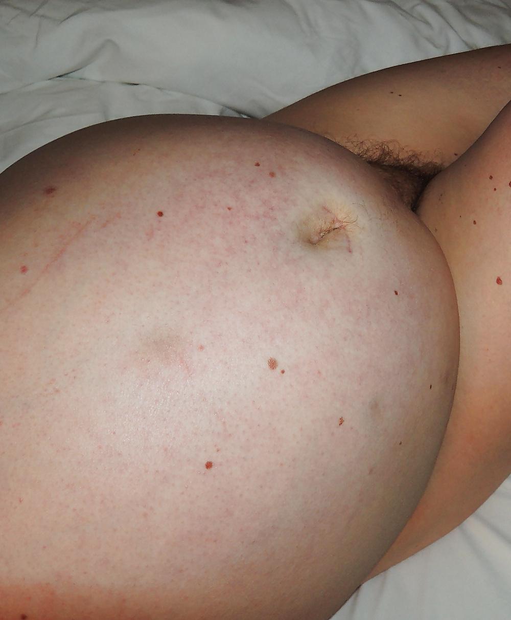 16P Im pregnant again 43 yo, this is from yesterday