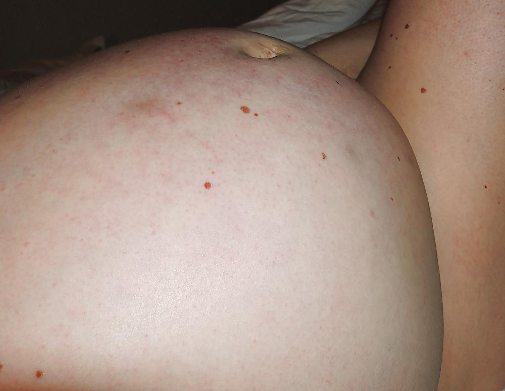 16P Im pregnant again 43 yo, this is from yesterday