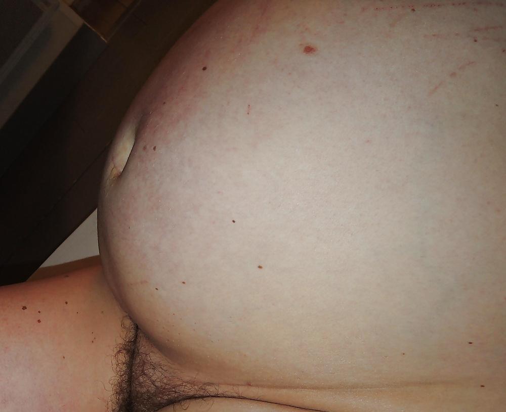 16P Im pregnant again 43 yo, this is from yesterday