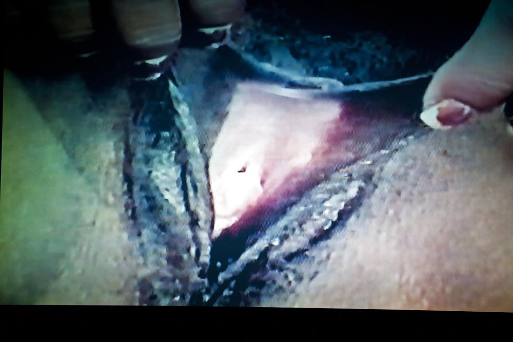 20P MARY O GROSSE PUSSY-LIPS