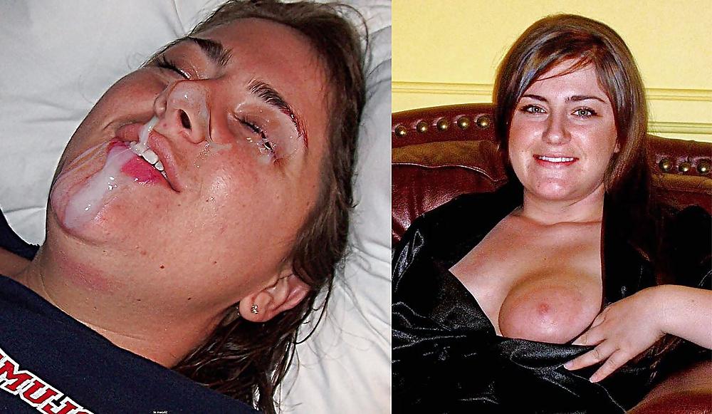 25P Before and after