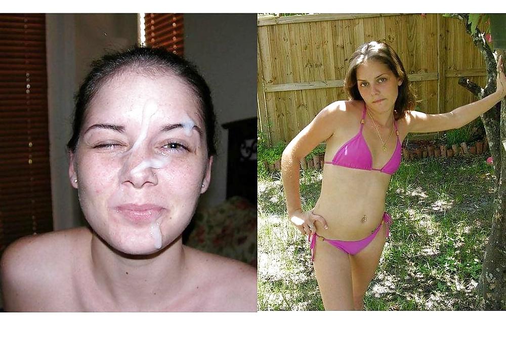 25P Before and after
