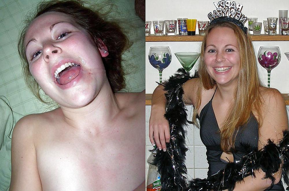 25P Before and after