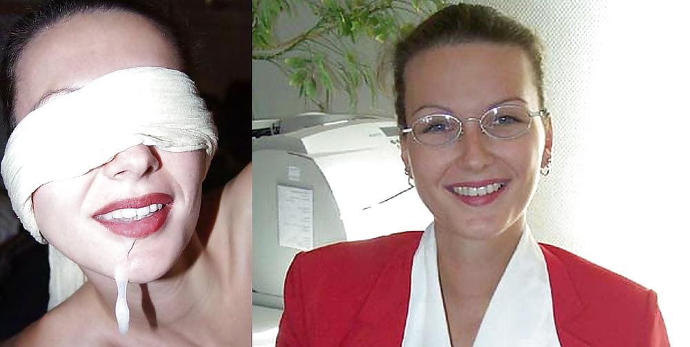 25P Before and after