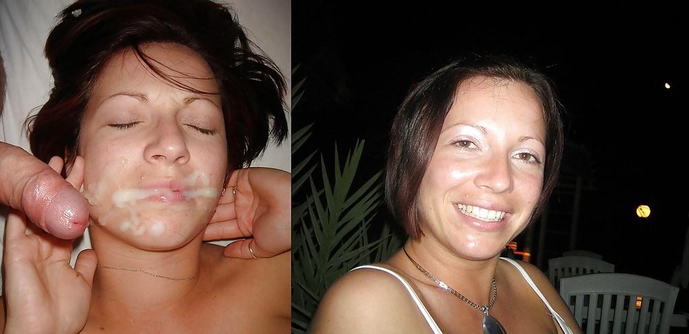25P Before and after