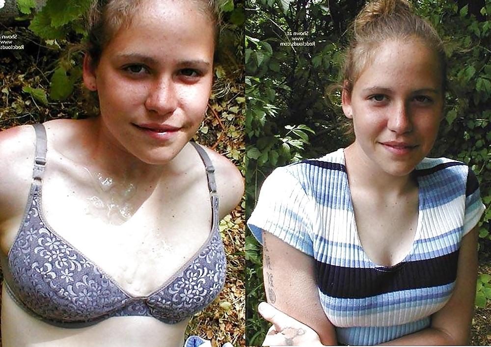 25P Before and after