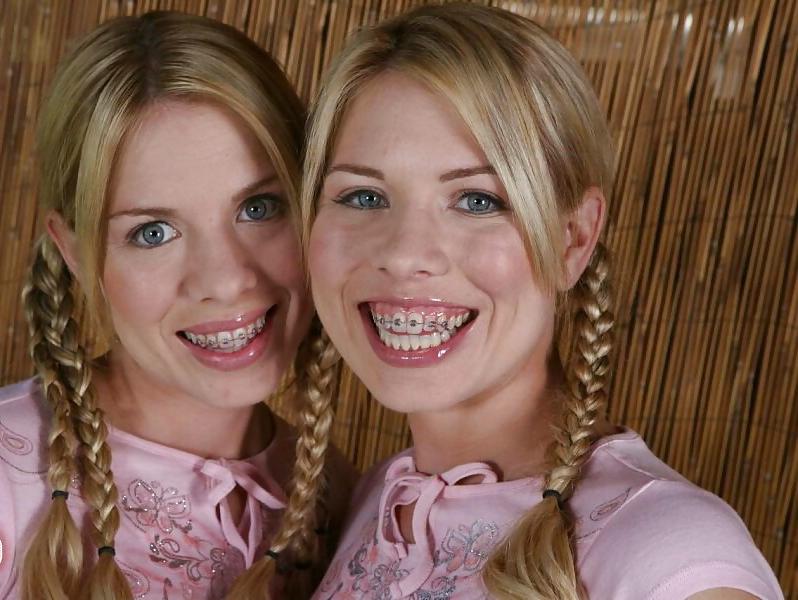 25P Whores With Braces