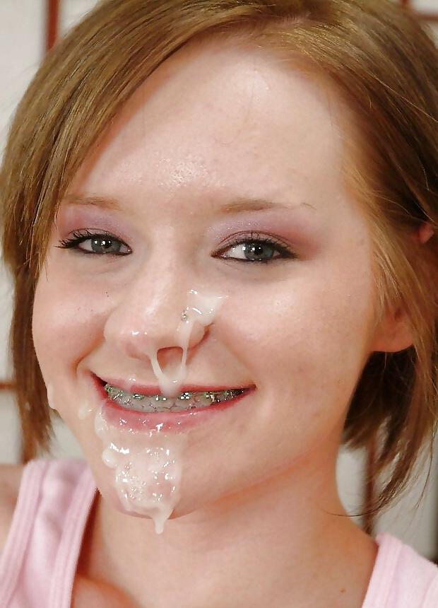 25P Whores With Braces