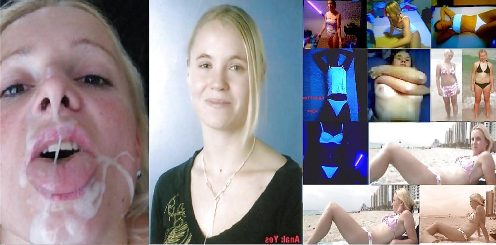 15P FACIALS- Before and After
