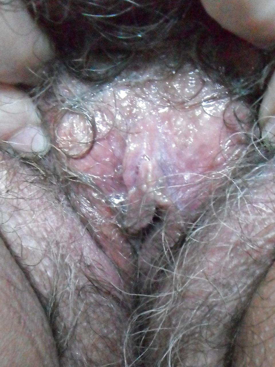 5P Like My Hairy Mature Wet Cunt?