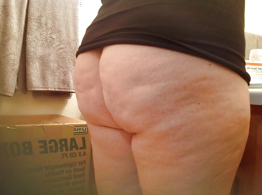 25P Thick, White and Cellulite 118
