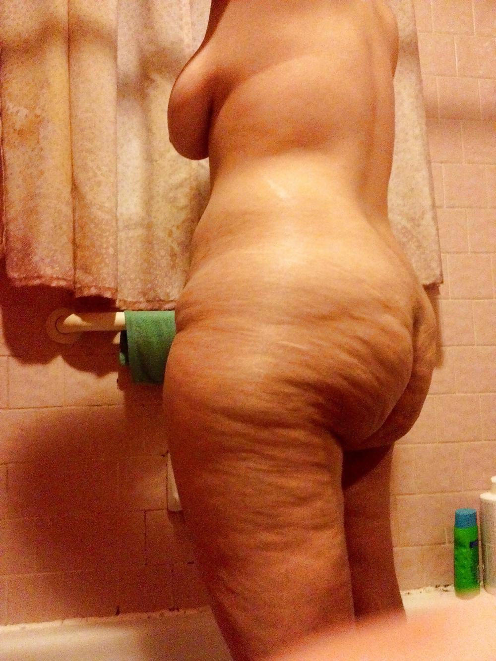 25P Thick, White and Cellulite 118
