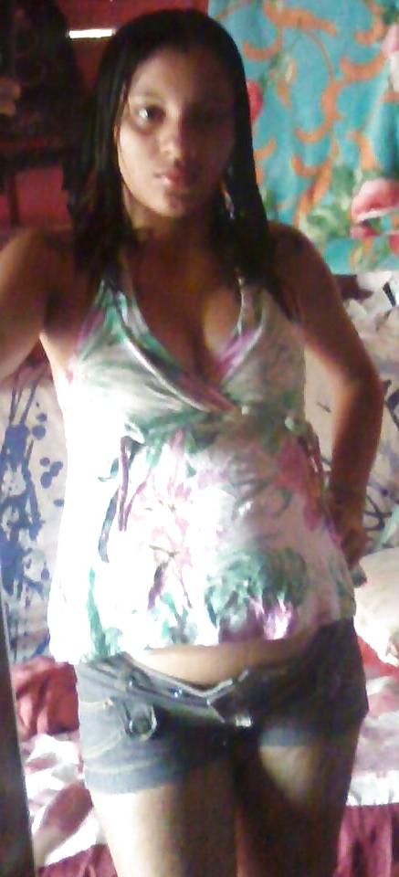 25P Pregnant girl
