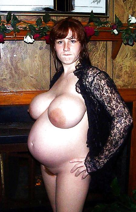 20P Darkened areola when pregnant
