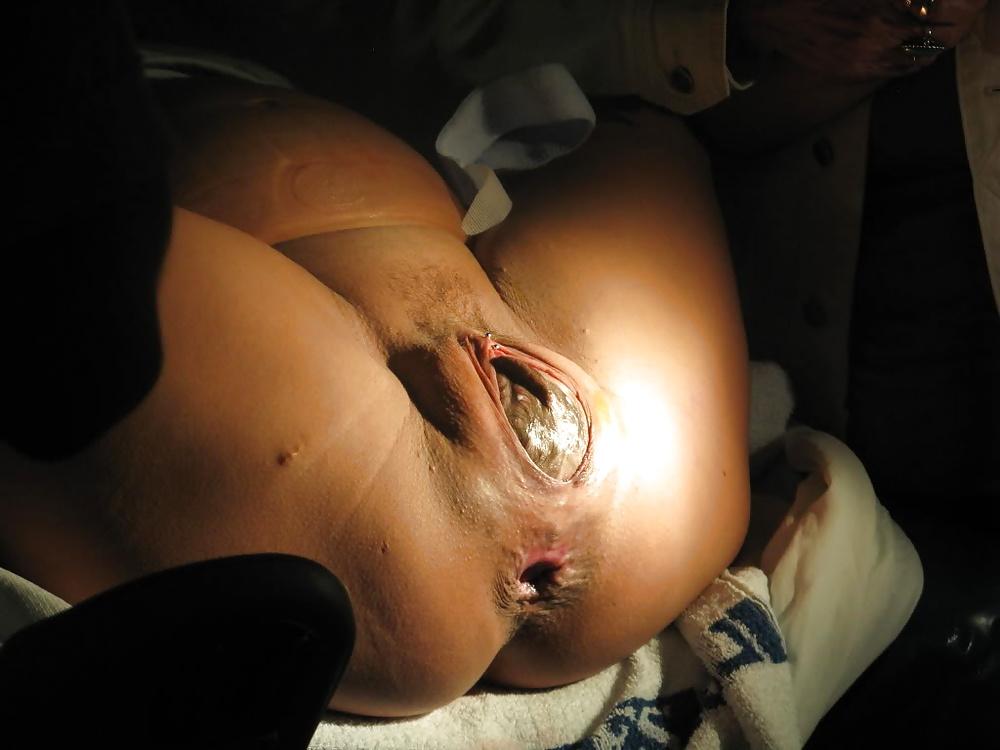 11P Pregnant special