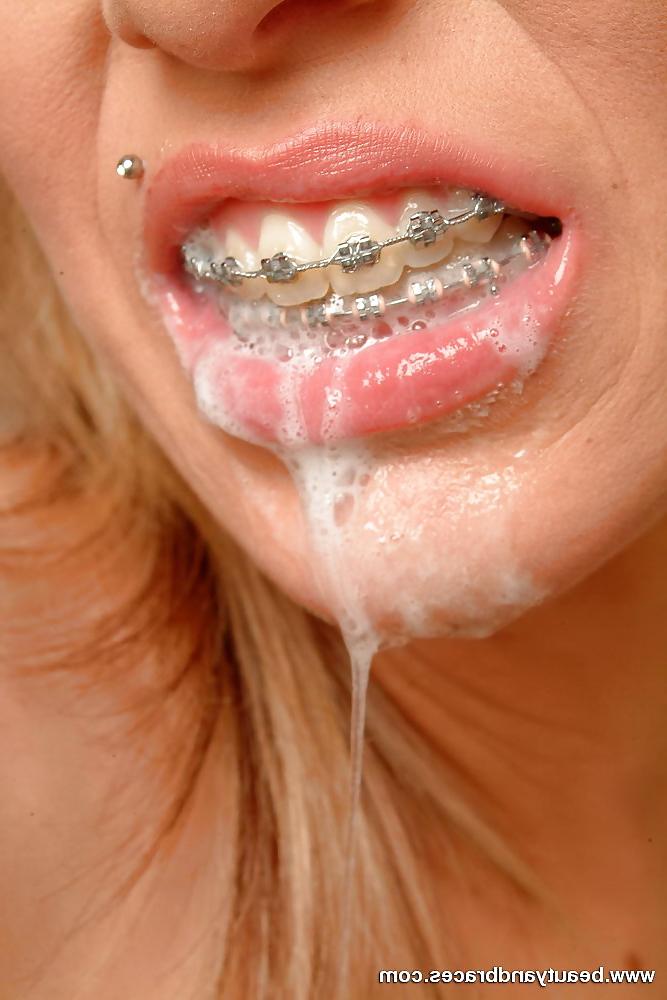 12P Cum Braces..